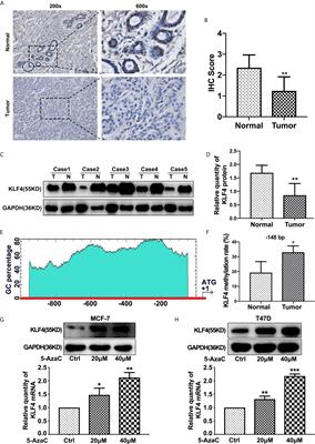 3,3’-Diindolylmethane Enhances Paclitaxel Sensitivity by Suppressing DNMT1-Mediated KLF4 Methylation in Breast Cancer